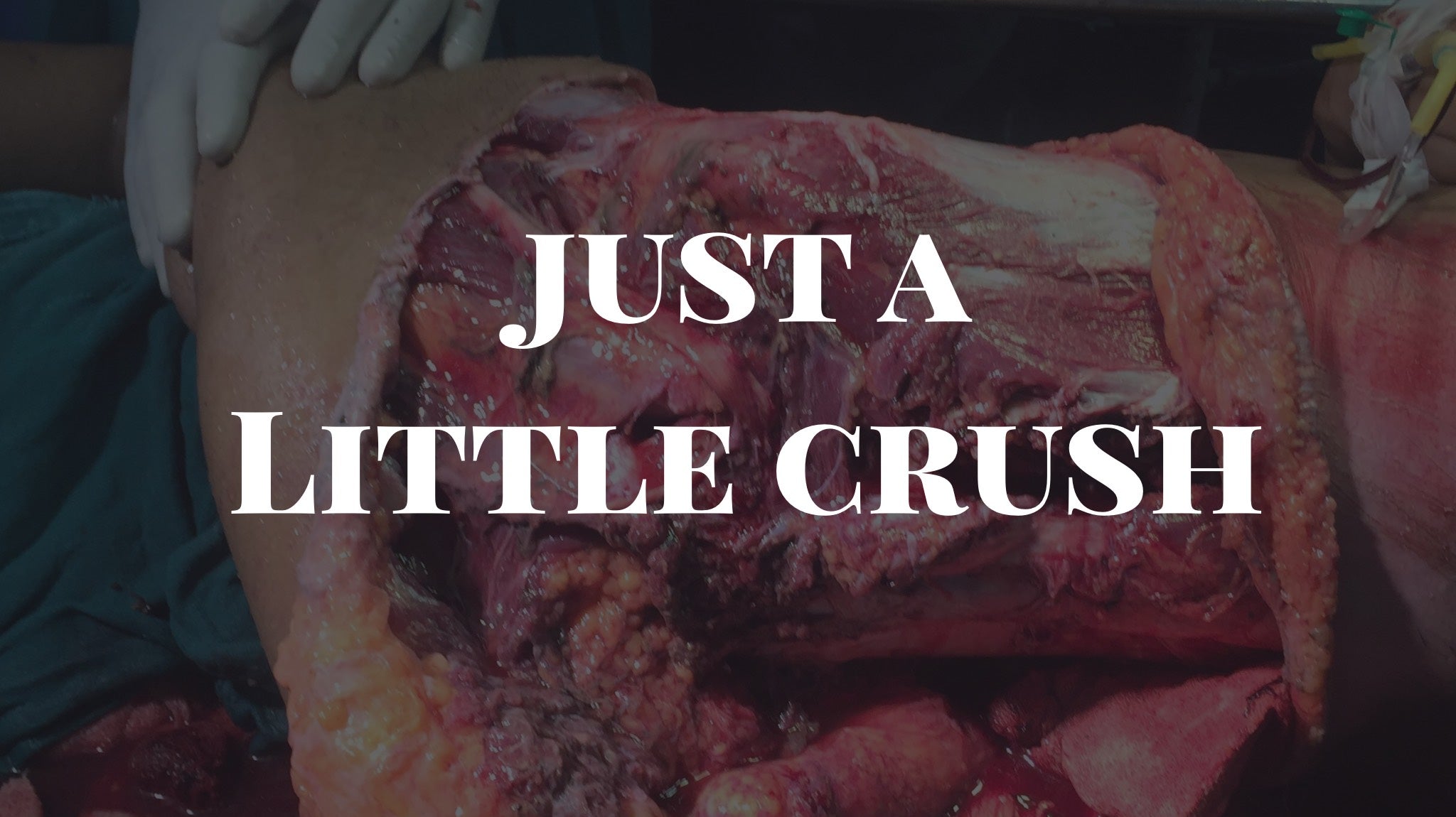 It’s Just, a little Crush….