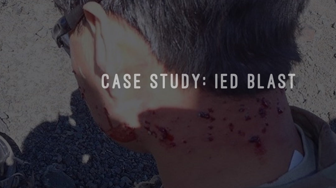 Case Study: IED Blast