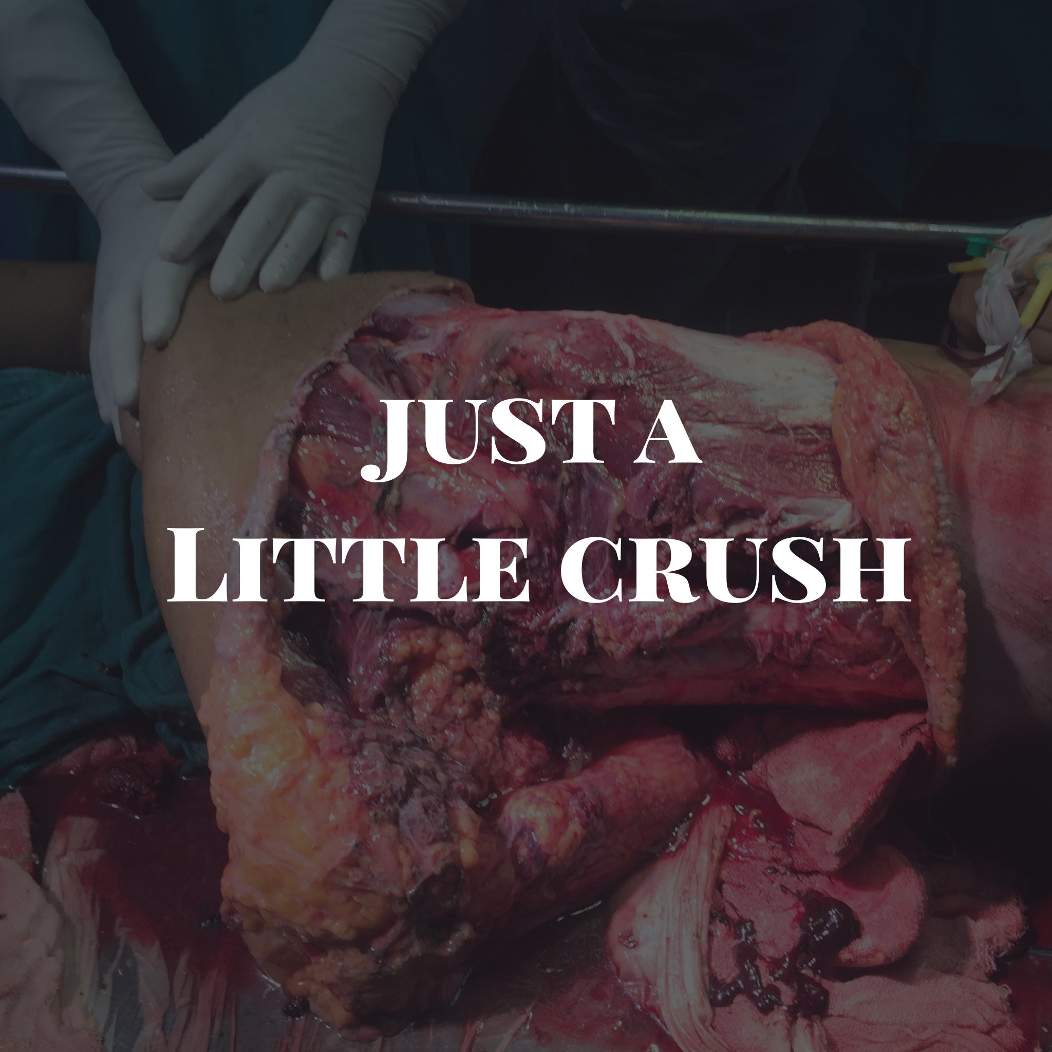 It’s Just, a little Crush….