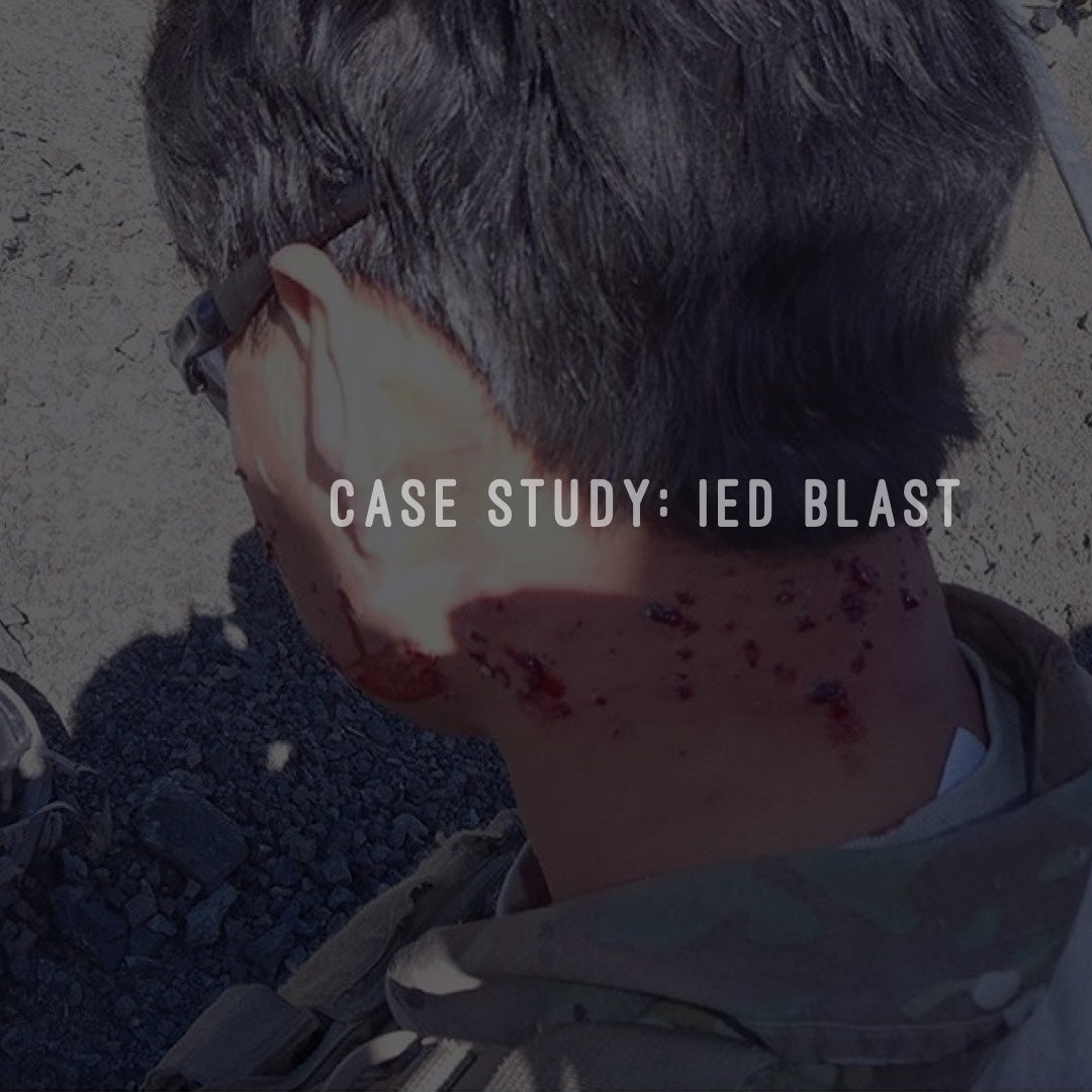Case Study: IED Blast